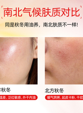 阿芙南方北方姐妹油养包体验装