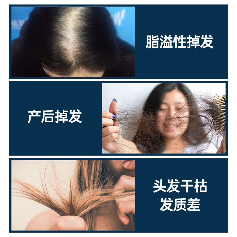 gloryfeel养发硅素生物素b7固护发 GloryFeel海外复合维生素/矿物质