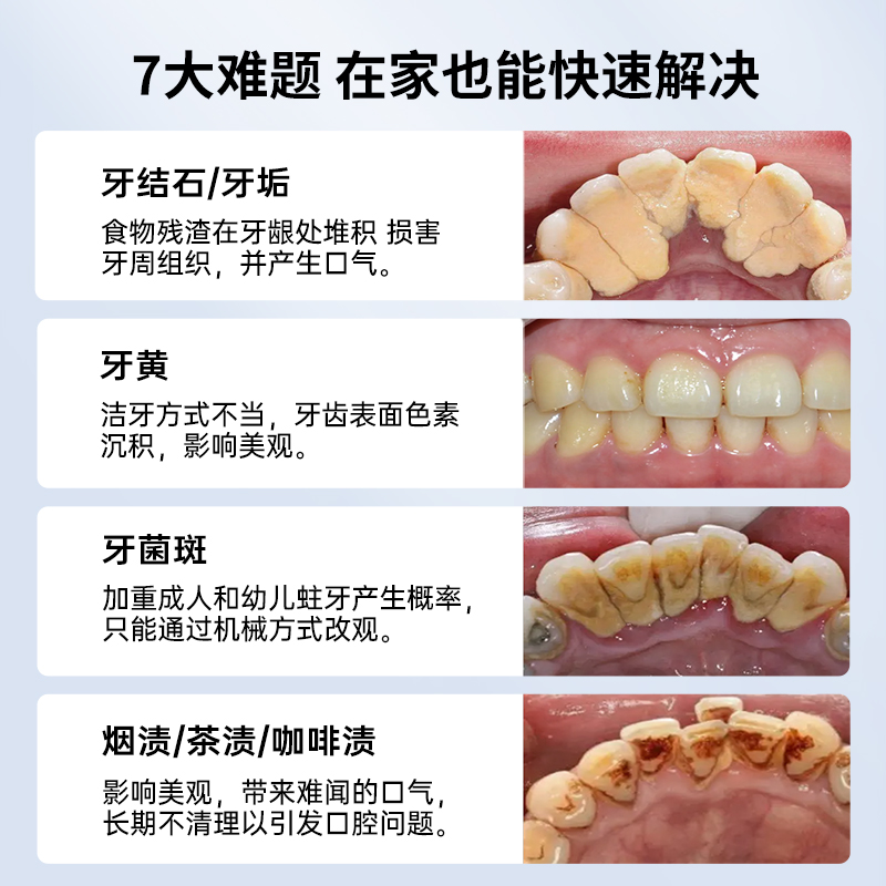 TFLASH同诗超声波洗牙器洁牙仪冲牙结石去除神器洗牙齿污垢器-图0