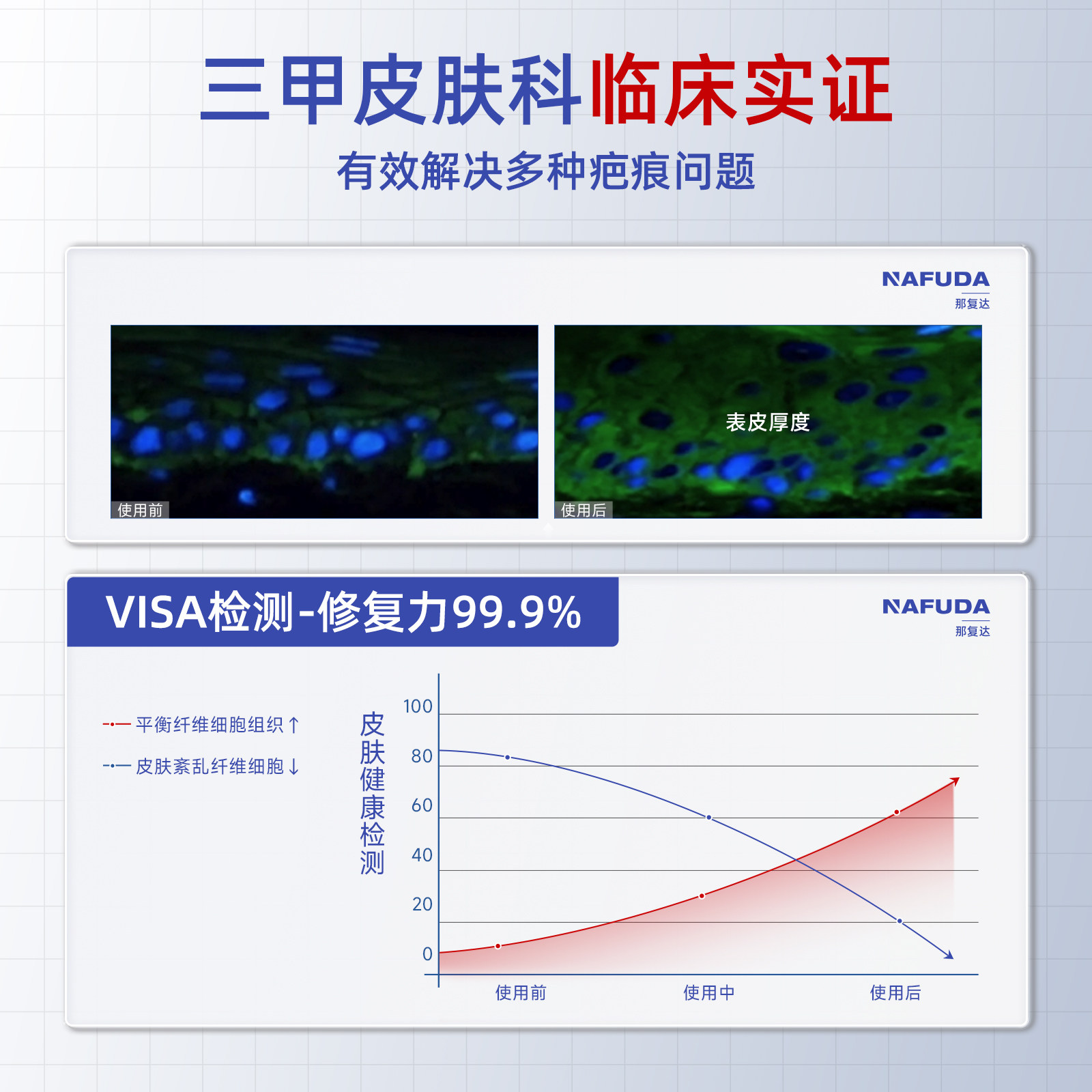 【三甲医用】那复达疤痕贴医用硅酮敷料剖腹产印增生修复除祛疤