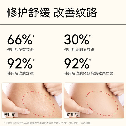 freiol福来抚纹油身体油防纹滋润按摩保湿补水身体护理精华油 - 图2