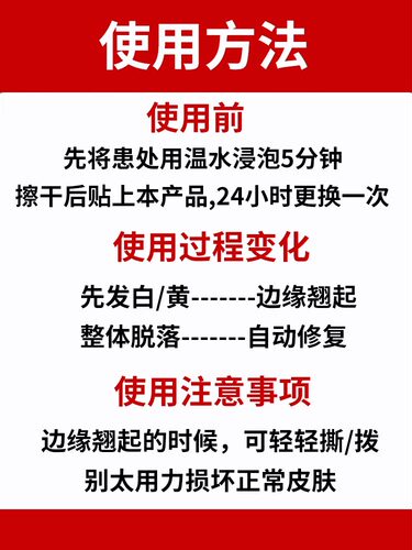 南京同仁堂足部脚底脚趾手部鸡茧贴鸡眼膏贴老茧贴正品旗舰店日本-图2