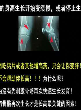 大长腿长高贴生长激素增高垫钙片