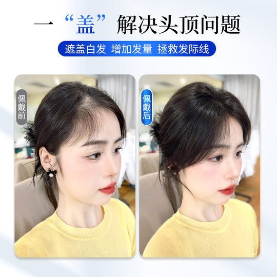 Cloudy, light and natural hair replacement patch