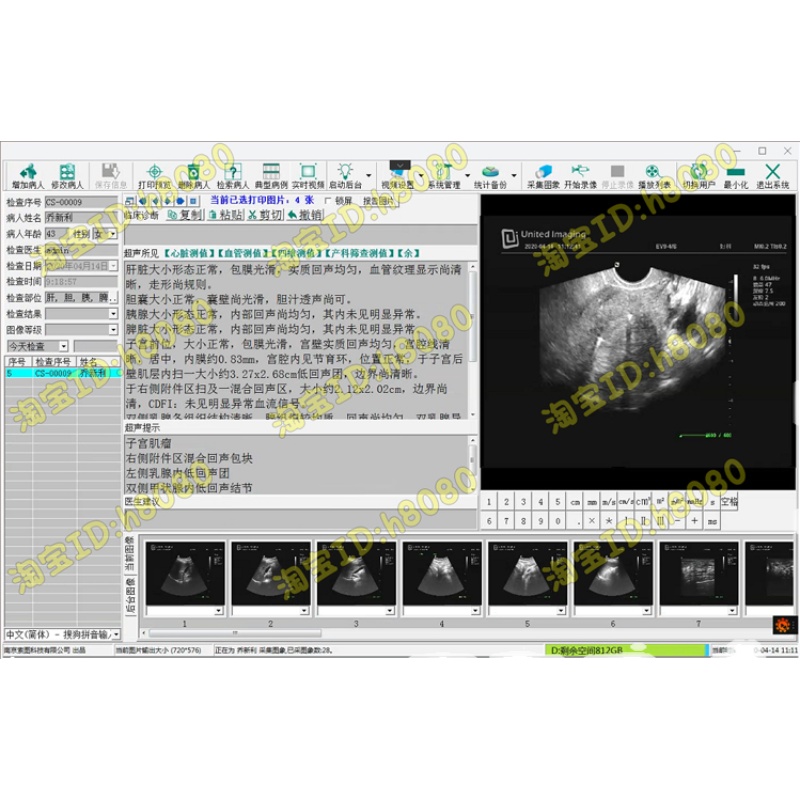 新索图超声软件索图B超软件四维彩超索图彩超软件加密狗win7win10 - 图3