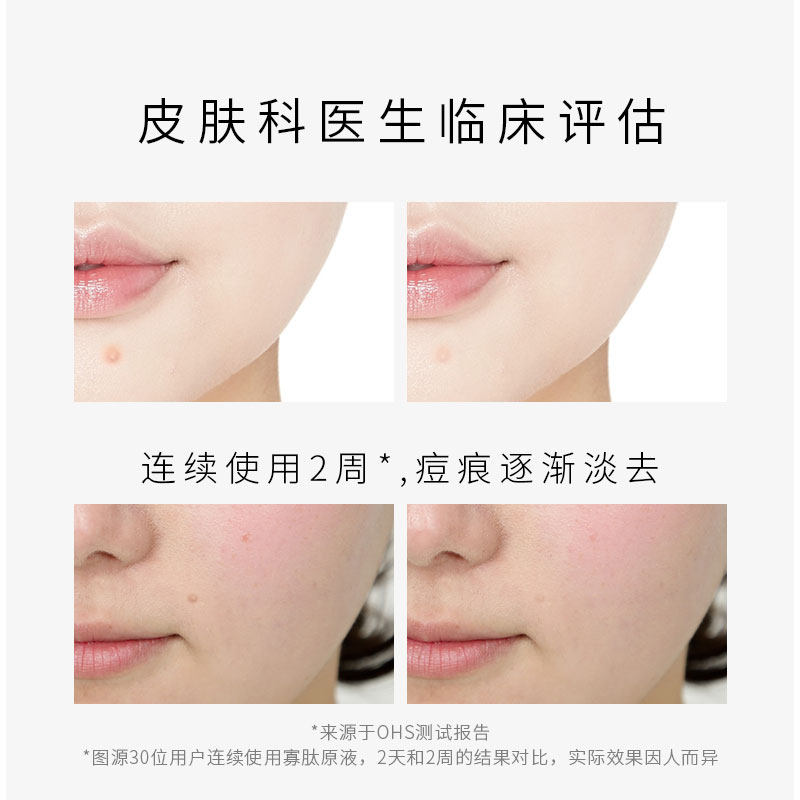 ohs寡肽祛痘抗痘修复皮肤精华液 OHS液态精华