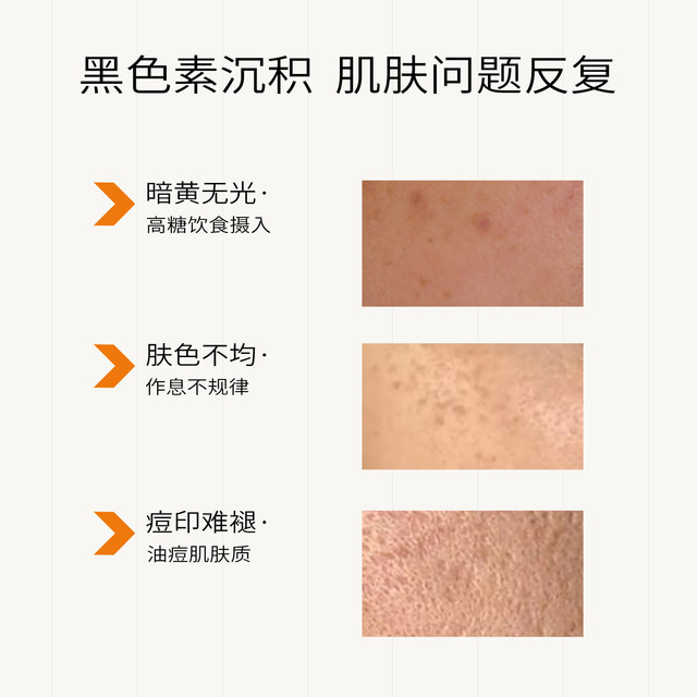 Zhifulian hya brightens the complexion and fades the face Zhifulian hya brightens the complexion and fades the face