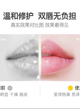 skinvape未来润唇膏凡士林护唇膏保湿滋润唇油去死皮唇膜官方正品