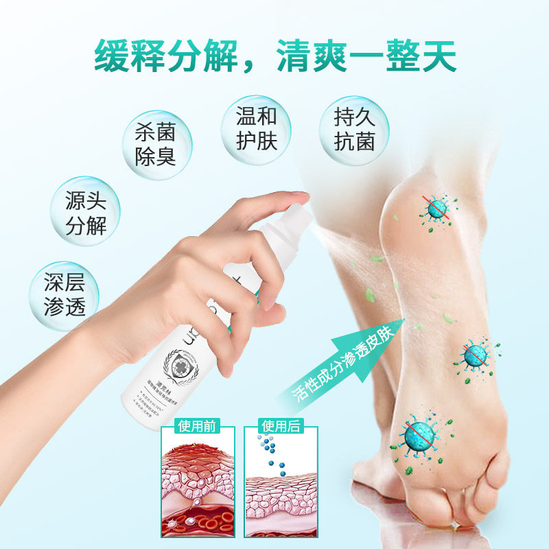 澳克林脚臭鞋袜除臭喷雾快速清新剂 澳克林空气芳香剂