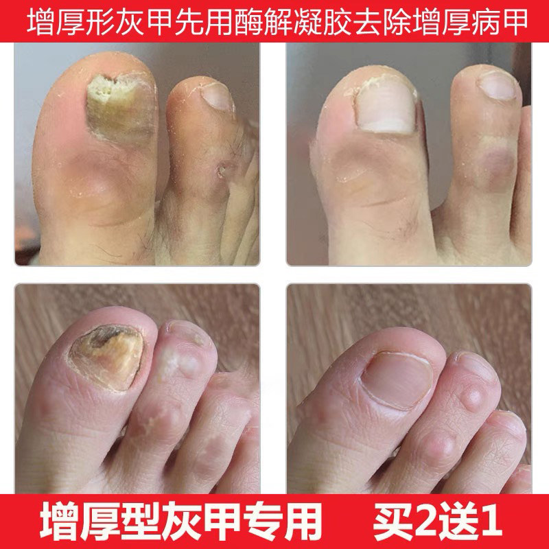  方保医疗器械保健理疗