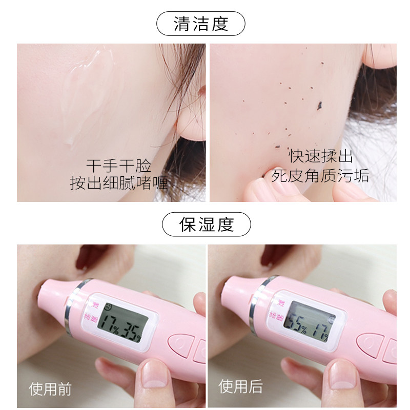 蜜诗肌去角质酵素深层清洁套装泥膜 蜜诗肌面部磨砂/去角质