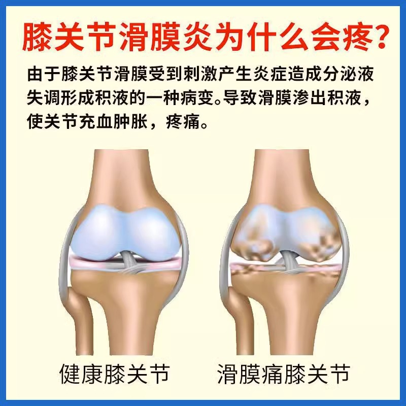 日本滑膜炎膝盖贴关节疼痛膏半月板损伤贴膏药积水风湿关节痛专用-图3