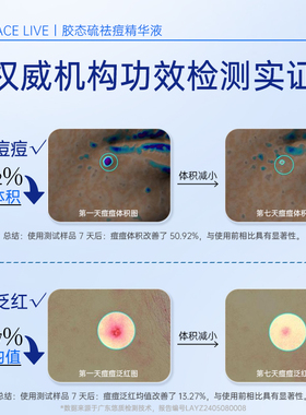 斐思妮胶态硫抑痘祛痘舒缓精华液