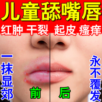 Children Lipstick Special Medicine Kid Licking Lips Mouth Zhou Dermatitis Lips Dry Peel Dry Cracking Red Swollen Itching Moisturizing Lipstick