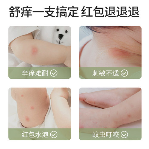 植物主义紫草膏婴儿宝宝儿童婴幼儿青草蚊虫蚊子叮咬止痒驱蚊专用 - 图3
