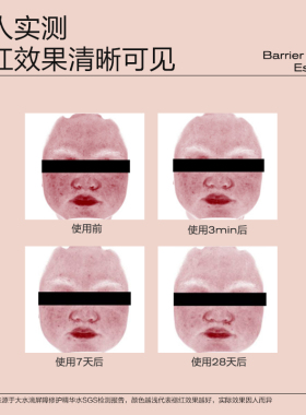 大水滴3点降燥水 湿敷精华爽肤降噪水修护舒缓褪红补水保湿化妆水