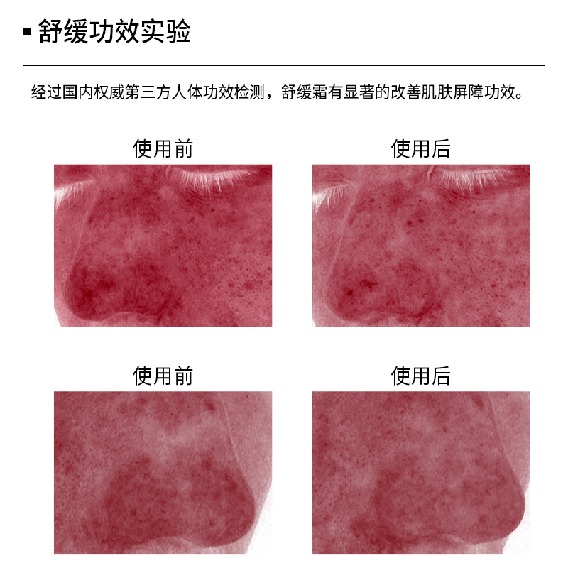 UNILIPO研知有理实验室大黄鸭舒缓面霜200g装保湿改善肌肤屏障-图0