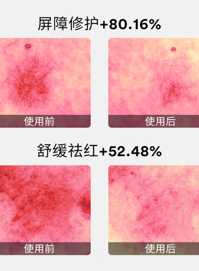 Abib阿彼芙11%依克多因泛醇皮肤修复屏障面霜保湿补水滋润女士