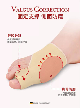 拇指外翻分趾鞋垫矫正
