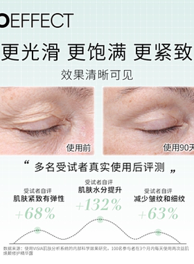 蓓欧菲淡纹修护精华露冰岛进口