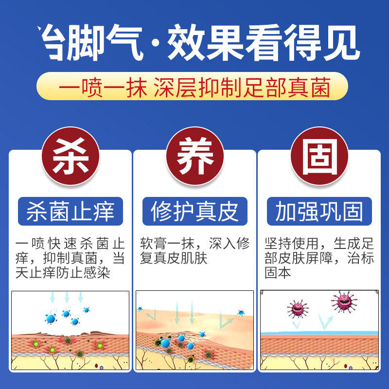 脚气克星脚起水泡痒脱皮止痒药喷剂 杨工坊皮肤消毒护理（消）