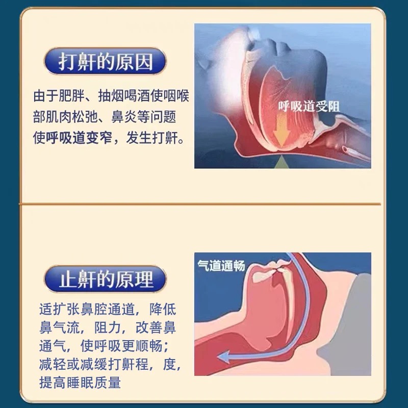 防打呼噜止鼾器专用膏药贴特贴片鼻炎学生成人专用效睡觉神器女DF-图2