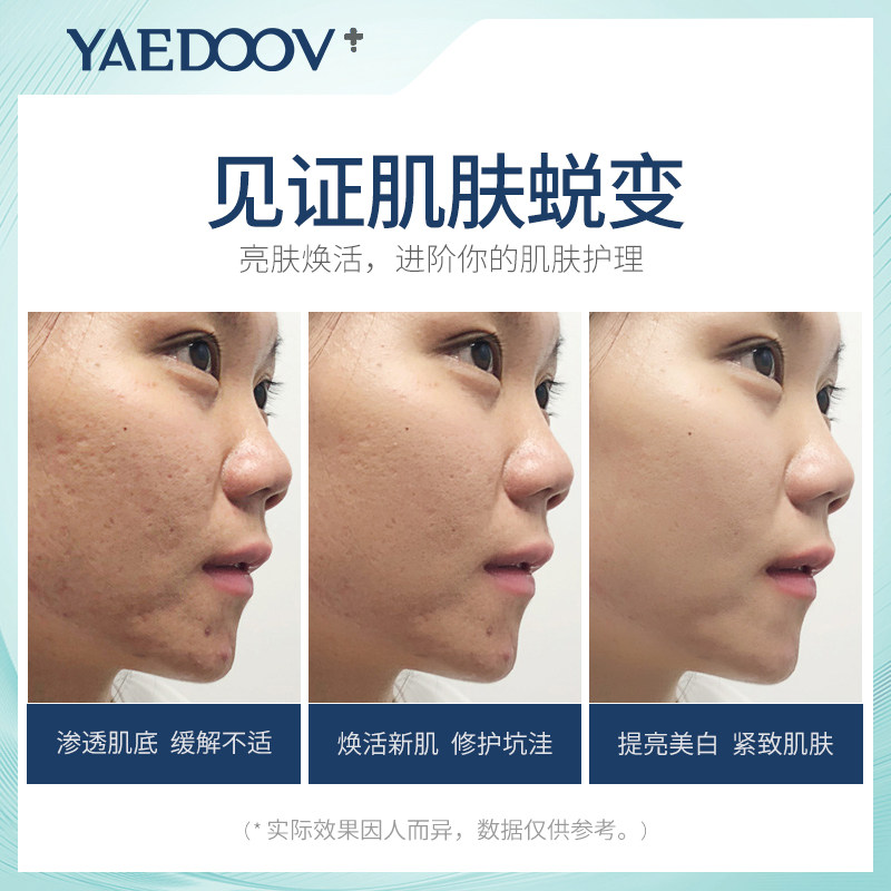 英国雅伯顿羊胎素酵母60补水冻干粉 雅伯顿液态精华