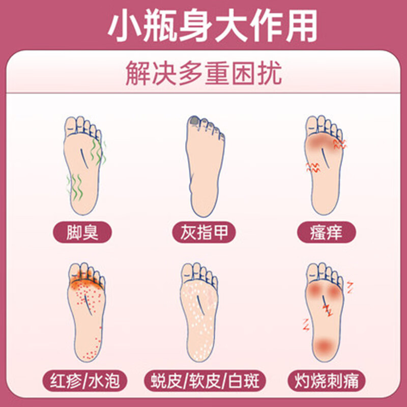 脚气真菌水日本灰指甲 脚气去根神器日本小林制药脚气水喷雾 - 图1