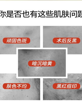 敷尔佳烟酰胺美白淡斑精华乳面膜贴淡化色斑暗沉提亮肤色男女通用