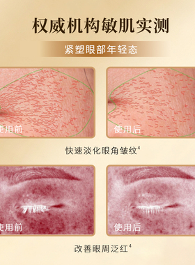 ANKELIFE/安科丽紧致抗皱眼部精华油补水舒缓提亮淡化细纹眼袋