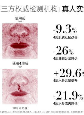 【预售付定】欧玛B5精华15ml*4瓶20%玻尿酸舒缓囤货
