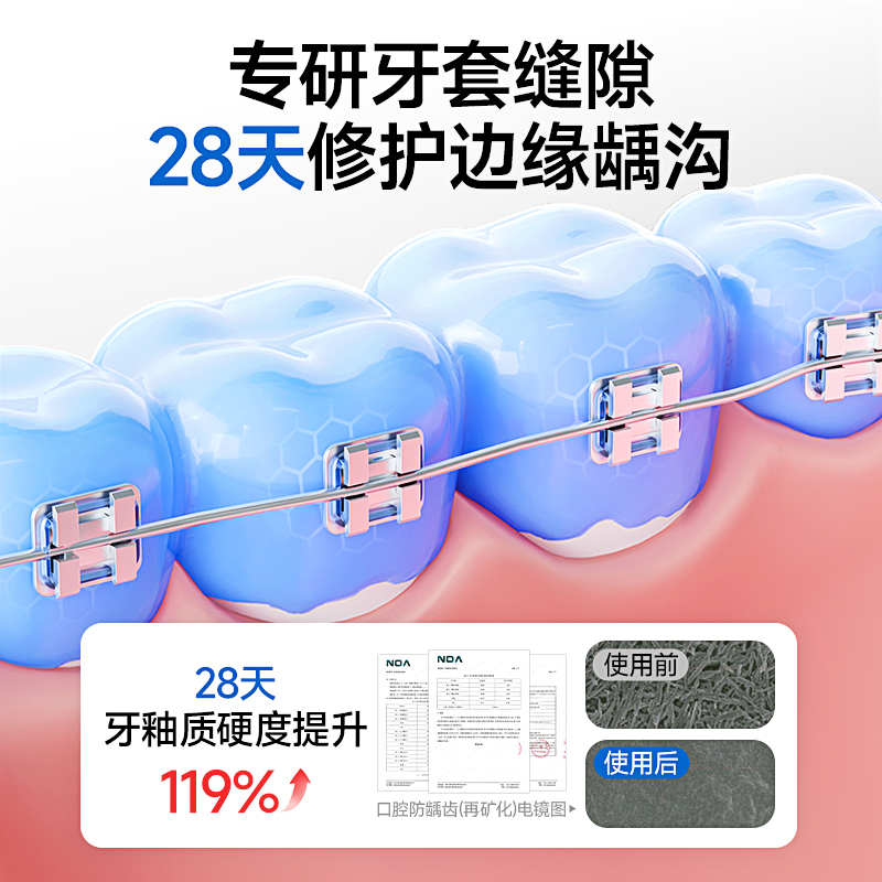 青少年儿童牙膏含氟防蛀牙龋齿美白12岁小初高中生10去口臭去黄渍