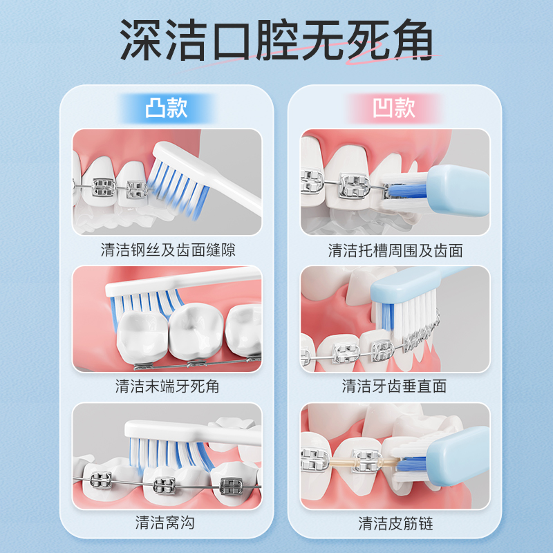 正畸牙刷正崎成人矫正牙齿专用牙刷软毛小头便携箍整牙戴牙套缝刷