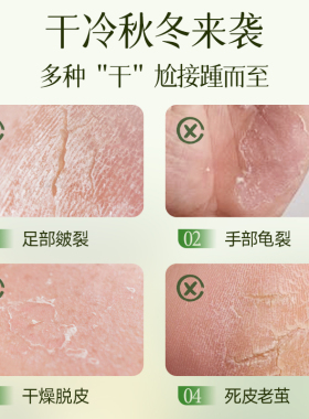 nak皴裂膏保湿滋润脚后跟干裂