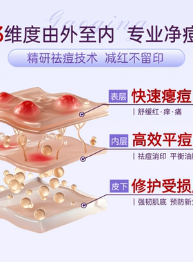 壬二酸20%祛痘控油质量润肤包邮