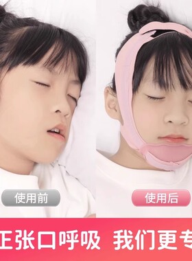 口呼吸矫正器睡觉防张嘴物理闭嘴纠正儿童贴防止嘴巴打呼噜止鼾带