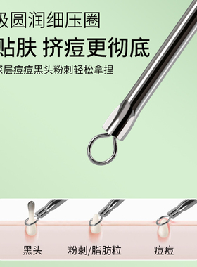 粉刺针美容院专用极细暗疮黑头针