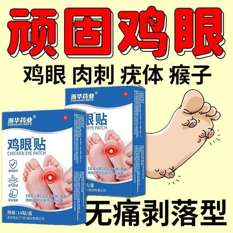 鸡眼贴正品强效祛老茧跖疣刺瘊鸡眼贴脚垫硬块祛手足部肉刺中药材,淘宝优惠券,粉丝福利购,淘宝优惠卷