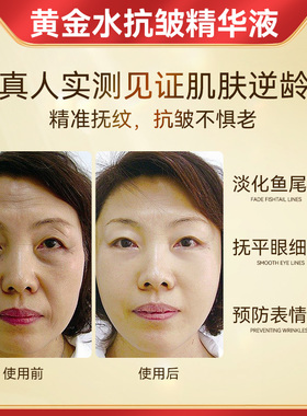 轻龄大师抗老精华面部提拉紧致
