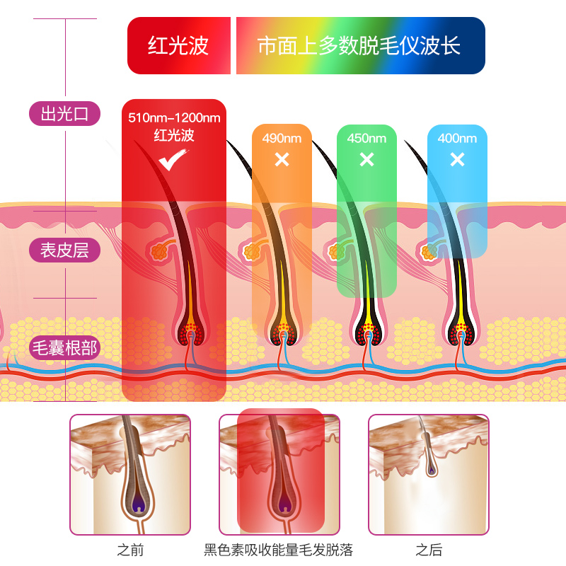 奥克斯红光波冰点脱毛仪器医用家用全身私处去毛唇部女士专用神器 - 图0