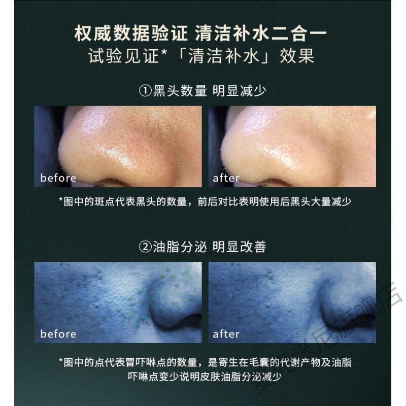  麦克米尼皮肤测试仪器