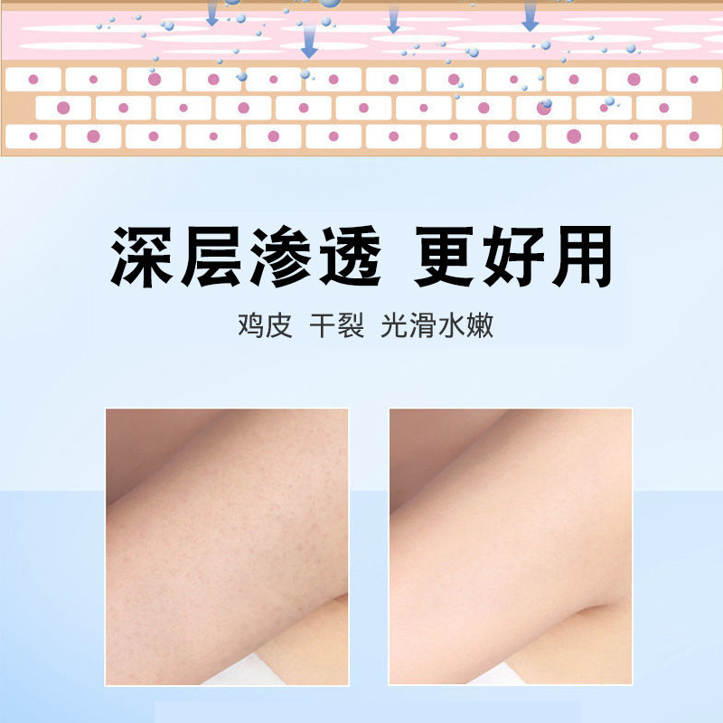 维e尿素霜正品10%身体乳ve乳膏 小禾诗蔓医疗器械皮肤消毒护理（消）