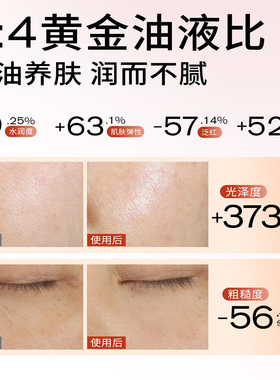 【自播专享】PMPM玫瑰精华油4.0嫩亮套装VC抗皱紧致修护