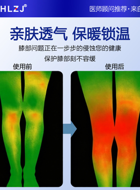 SHLZJ薄款夏季护膝盖女士关节暖