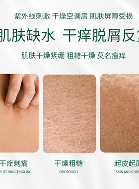 【双十一】官方正品颜伊施舒缓保湿滋润乳300g 长效保湿 舒缓不适