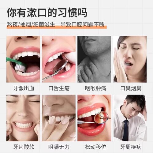 奇康西帕依固龈液官方旗舰店正品适用牙周炎牙龈萎缩松动医漱口水 - 图0