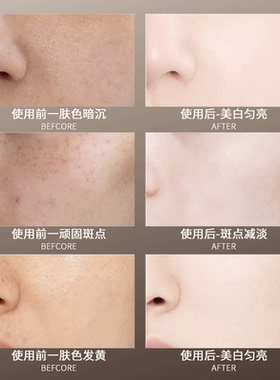 【专柜款】科图尔祛斑美白组合377VC面霜+肌底液+水+乳