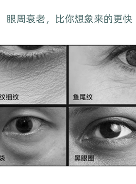 悦家YourGa护眼按摩仪