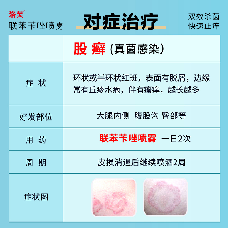洛芙联苯苄唑溶液笇唑喷雾脚气杀菌 知原癣症