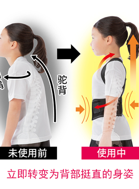 日本中大童矫正器needsuvcut